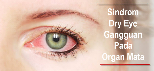 Apa Itu Sindrom Dry Eye?