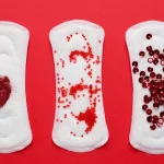 Menorrhagia: Gejala, Penyebab, dan Pengobatannya