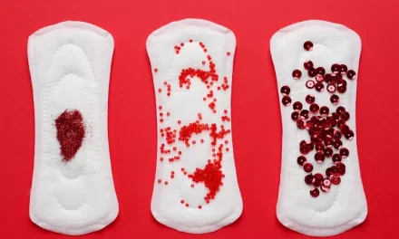 Menorrhagia: Gejala, Penyebab, dan Pengobatannya